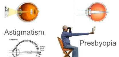 Τι είναι μυωπία, υπερμετρωπία, αστιγματισμός και πρεσβυωπία;